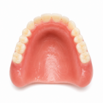 Denture Reline / Rebase