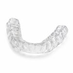 Occlusal Splint (Michigan Splint)