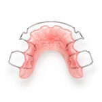 Retainer (Hawley / Essix)