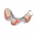 Tooth Addition (Adding Tooth to Existing Denture)