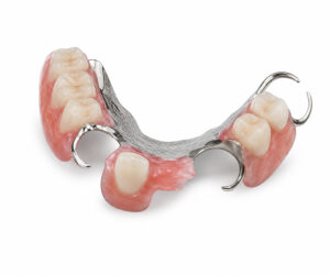 Tooth Addition (Adding Tooth to Existing Denture)